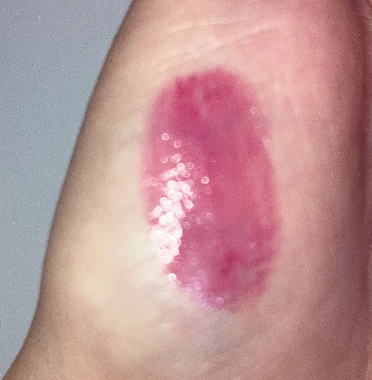 つやぷるリップR/b idol/口紅を使ったクチコミ（2枚目）