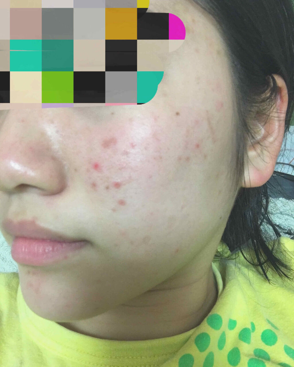 ハトムギ化粧水(ナチュリエ スキンコンディショナー R )/ナチュリエ/化粧水を使ったクチコミ（3枚目）