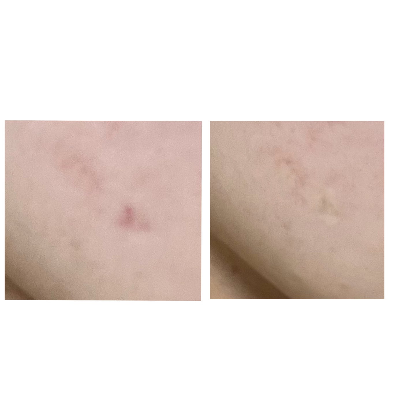 コンシールブレンダーパレット/LUNA/パレットコンシーラーを使ったクチコミ(5枚目)