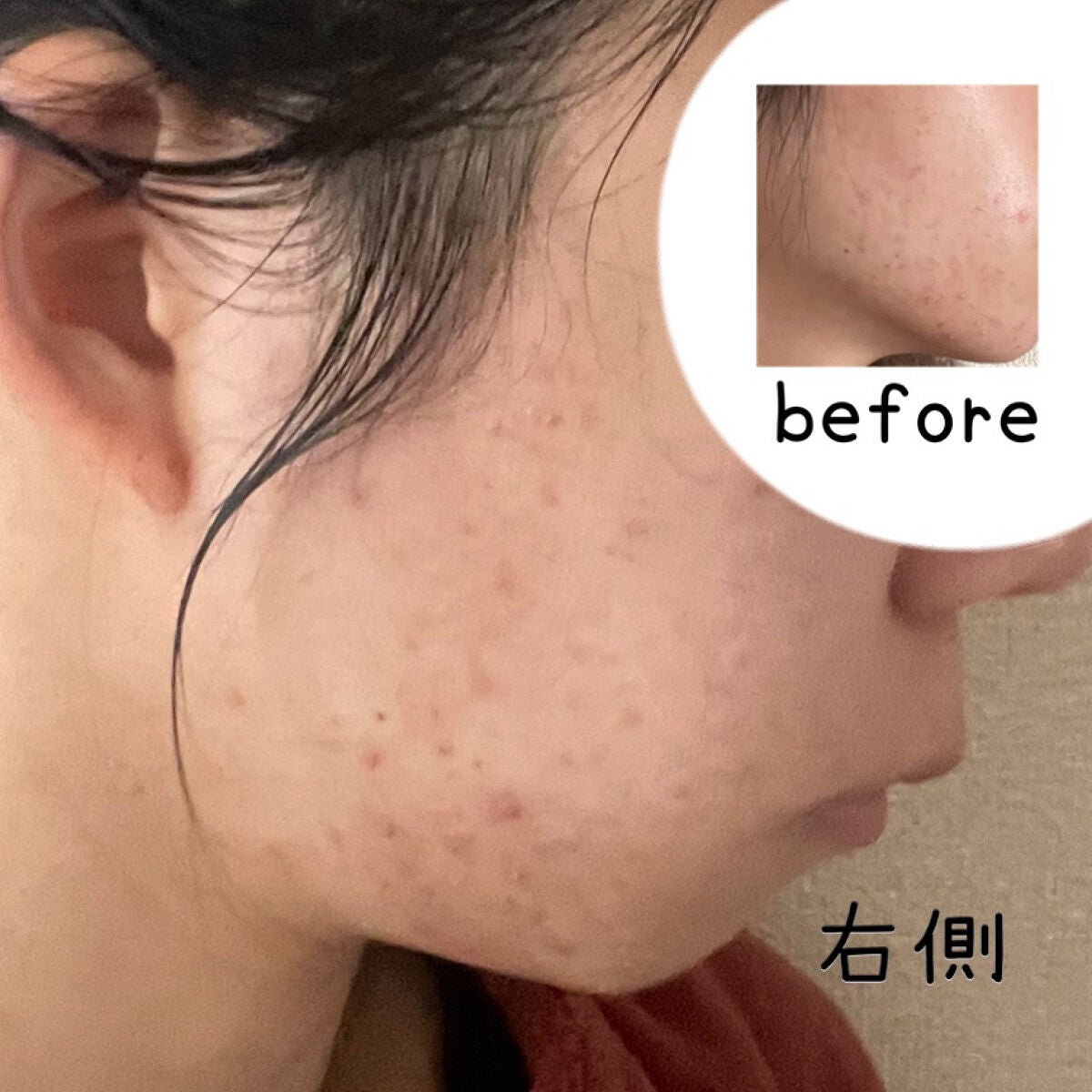 モイスチャージェル/パーフェクトワン/オールインワン化粧品を使ったクチコミ(3枚目)