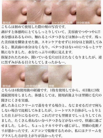 プランプハニー アクアセラムマスク/ByUR/シートマスク・パックを使ったクチコミ(4枚目)