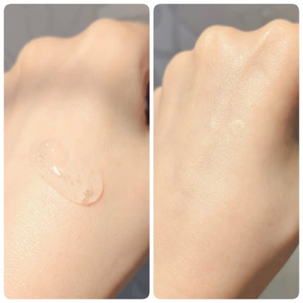 メディリフト ニードルリフトピールセラム/YA-MAN TOKYO JAPAN/美容液を使ったクチコミ(5枚目)