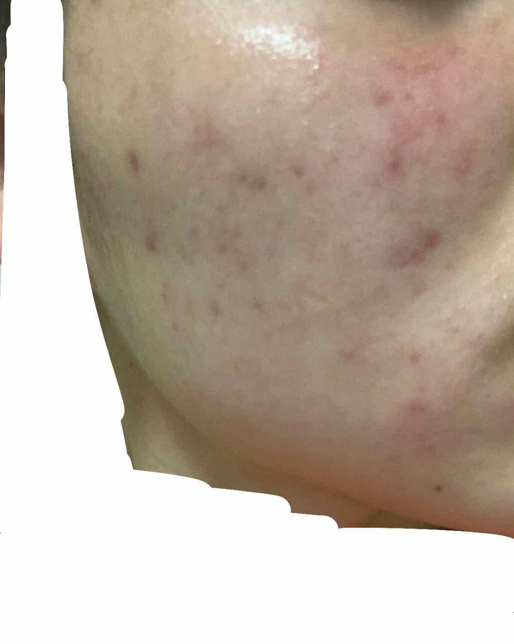 敏感肌用薬用美白美容液/無印良品/美容液を使ったクチコミ（2枚目）