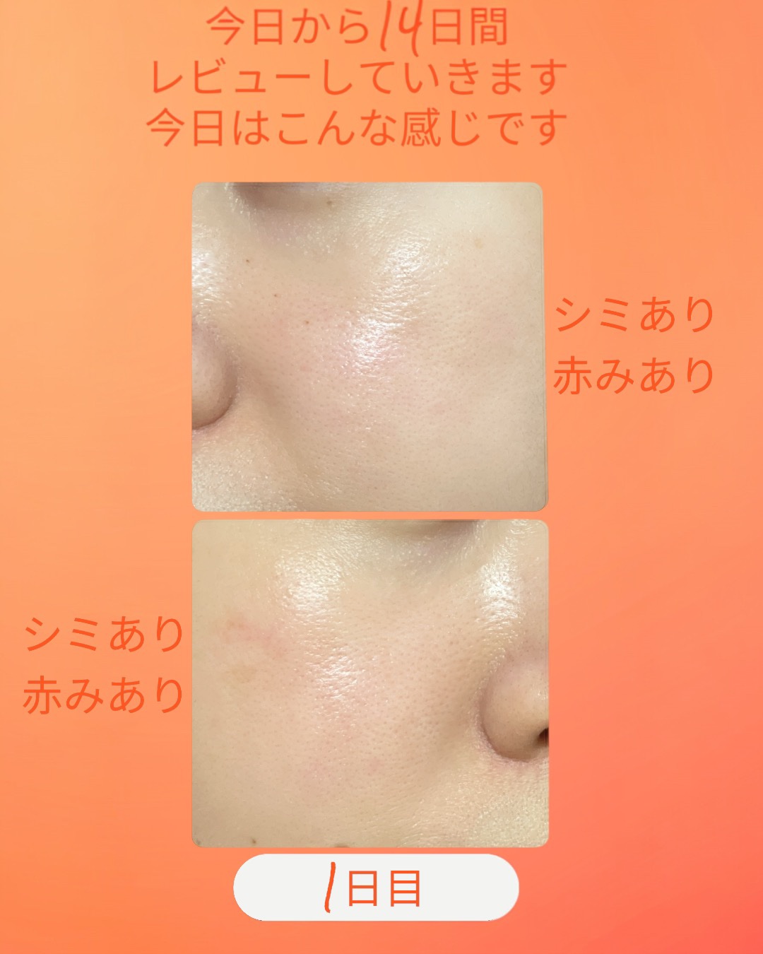 TXトーニングデイリーマスク/VT/その他スキンケアを使ったクチコミ（2枚目）