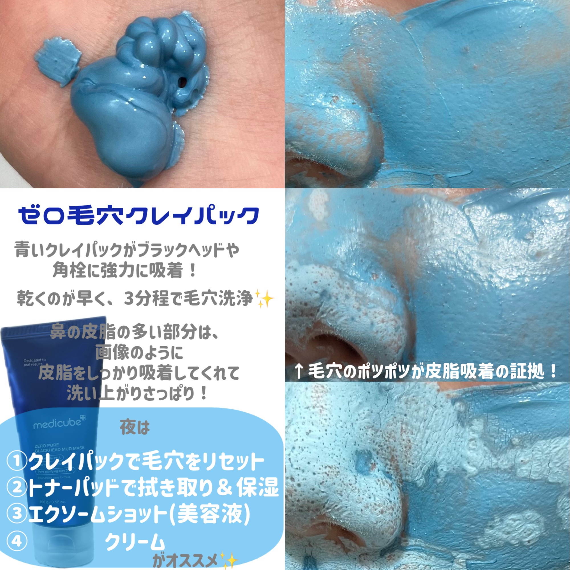 ゼロ毛穴パッド 2.0/MEDICUBE/トナーパッドを使ったクチコミ（2枚目）