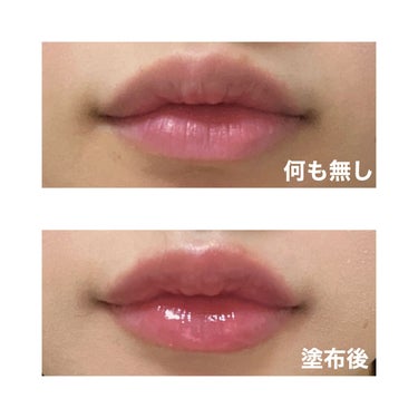 今回のオススメはこちらです💁🏻💡

【 keybo DOTOM Lip Plus Plumper 】

私の好きなYouTuberさんがおすすめしていたのを見て
つい気になってしまい気づいたらポチッと、、、、

韓国では有名？なリッププランパーだそうで
色つきのものも何種類かありましたが
普段使っているリップは使いたかったので今回は
どうせ買うならということで神と言われている
いわゆるレベルMAXのプランパーを購入しました😳

とにかくつけてびっくりしました「痛すぎる、、笑」
まさに辛いものを食べた時の唇の感覚です🌶！！
Diorのマキシマイザーなんて比になりません。笑

しかし痛いだけ効果あるとはまさにこのことで
カサカサだった唇があっという間にプルプルに、、、
私は血行がいいのか透明なはずのプランパーなのに
カプサイシンの効果でほんのり赤くなりました😹

家族にも「なんかプルプルじゃない？」と言われたほど
効果は抜群のリッププランパーです！！

ただ本当に痛いというかピリピリが30分くらい続くので
ピリピリ感が苦手な人にはお勧めできません😥
私は辛いものが苦手ですが耐えられるピリピリ感でした。

⚠️最初塗る時に何も考えず塗って失敗した点⚠️
①お風呂入る前に塗ってしまった
→一見なんでダメなの？と思うかもしれませんが
   辛いものを食べた後にわざわざ熱々の物を飲む人は
   いないですよね、、その理論です、、
   洗顔中とにかく唇が熱くて熱くて大後悔しました(笑)
   使う方は絶対お風呂前に塗らないでください😱
②塗りすぎ
→これも要注意です！
    少しでも口の中に入ったり舌についたりすると
    びっくりするほどそこまでピリピリします！
    少しずつつけて様子をみるのをオススメします😱

上記の失敗を除けば3枚めの画像のように
ぷっくり唇が塗ってすぐに手に入れられます！！
マスクが外せるようになってきた今だからこそ
使ってみるのはありかなと思います！オススメです！

ここまで読んでいただきありがとうございました☺️

の画像 その2