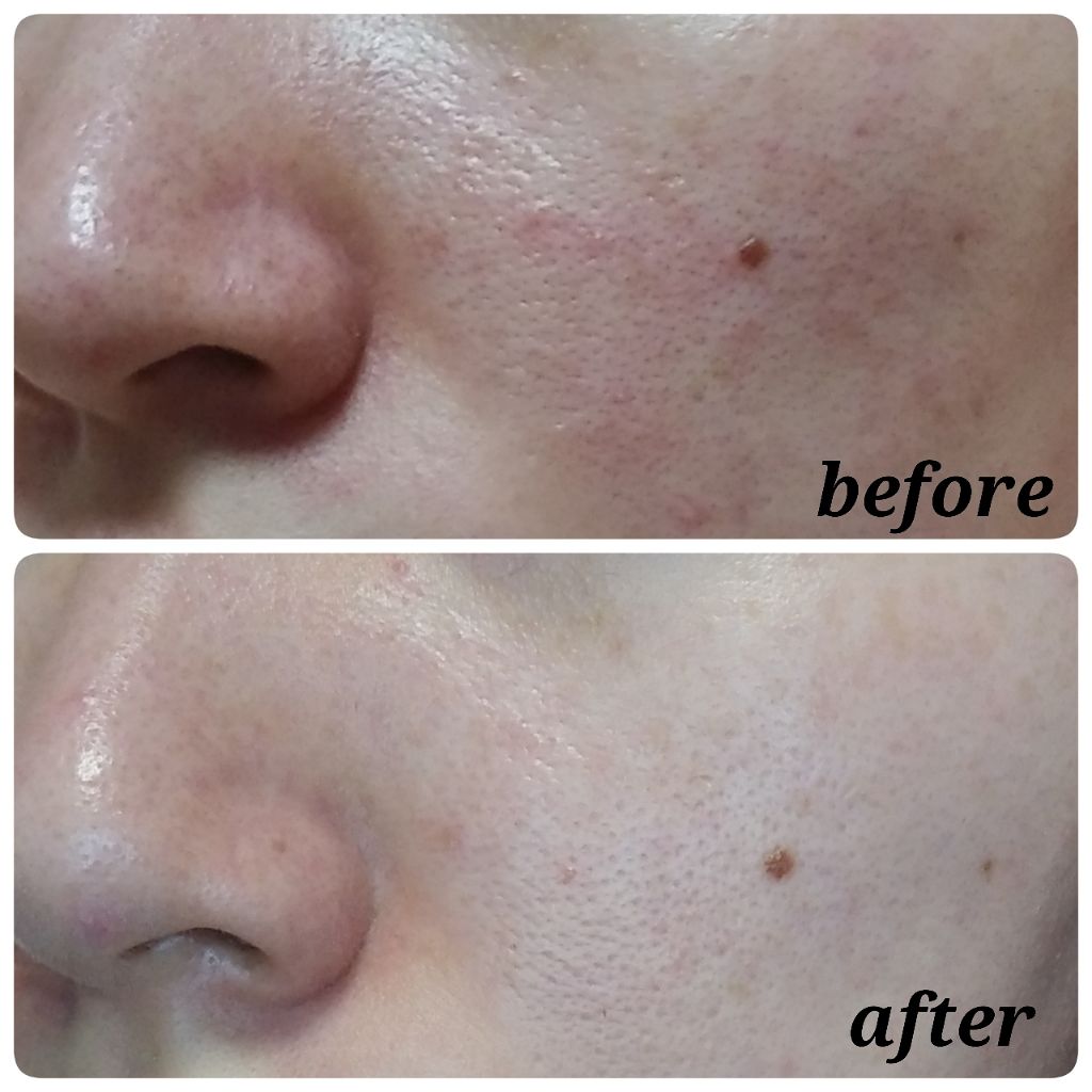 ハトムギ化粧水(ナチュリエ スキンコンディショナー R )/ナチュリエ/化粧水を使ったクチコミ(2枚目)