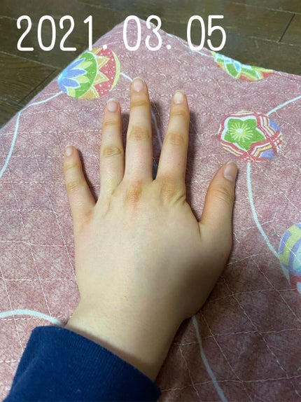 キューティクルオイル/ネイルホリック/ネイルオイル・トリートメントを使ったクチコミ(3枚目)