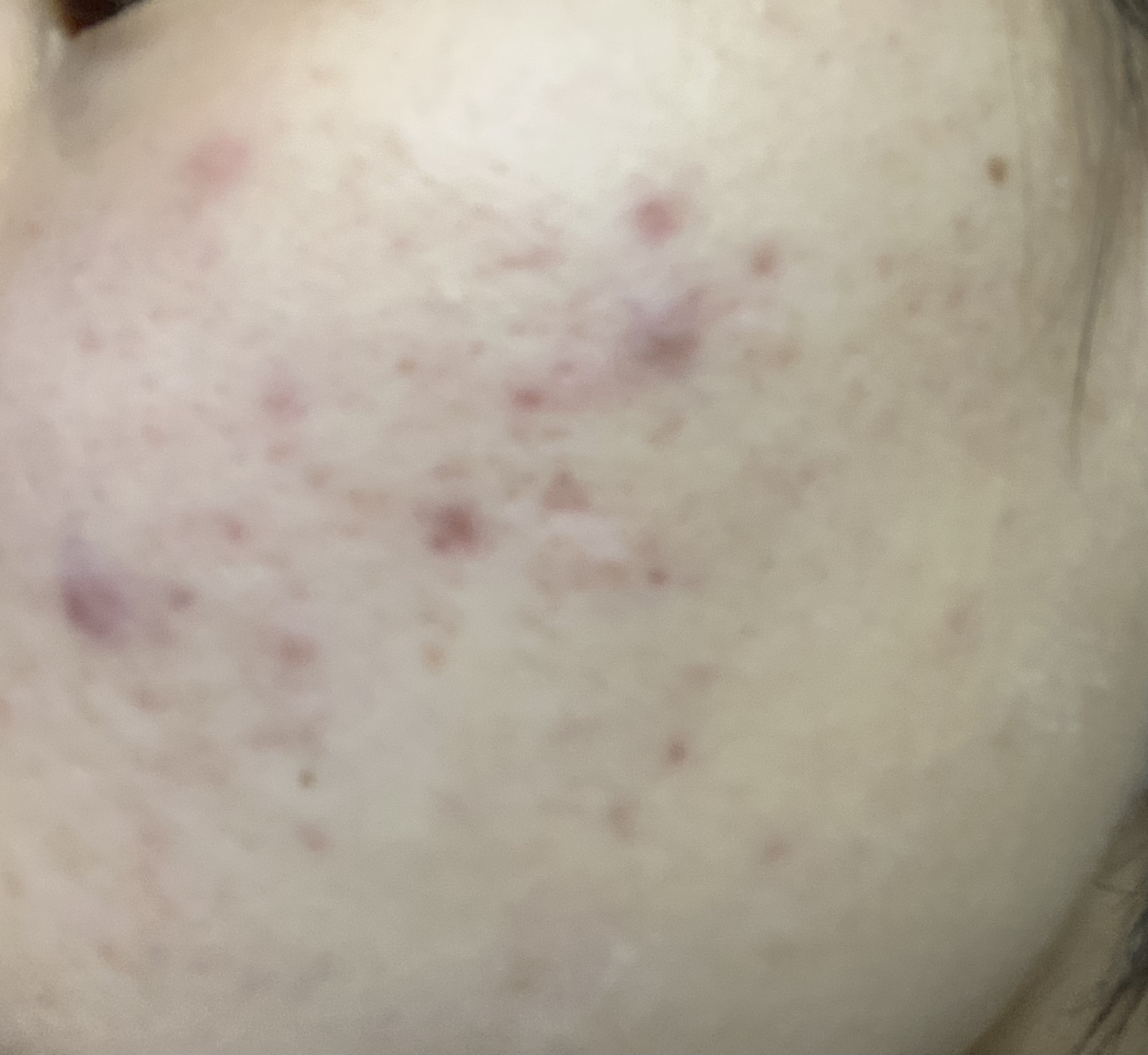 敏感肌用化粧水　しっとり/無印良品/化粧水を使ったクチコミ（2枚目）