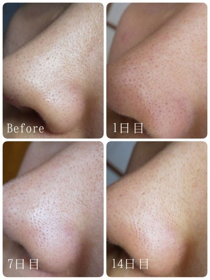 デュオ ザ クレンジングバーム クリア/DUO/クレンジングバームを使ったクチコミ(2枚目)