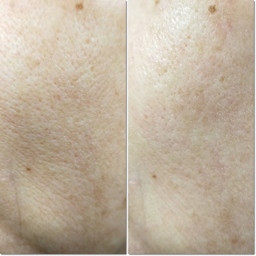 バイオームバリアシートマスク/UIQ/シートマスク・パックを使ったクチコミ(6枚目)