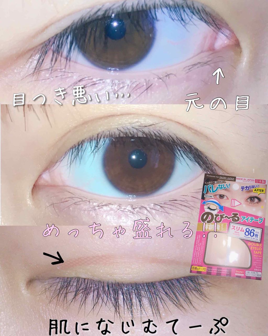 のびーるアイテープ（絆創膏タイプ、レギュラー）/DAISO/二重まぶた用アイテムを使ったクチコミ（2枚目）