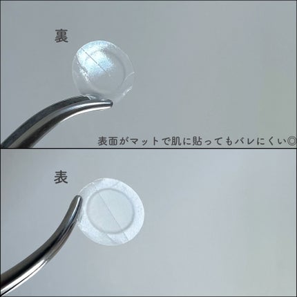 ビューティーミラクルパッチスポットカバー/Rael/にきびパッチを使ったクチコミ(5枚目)