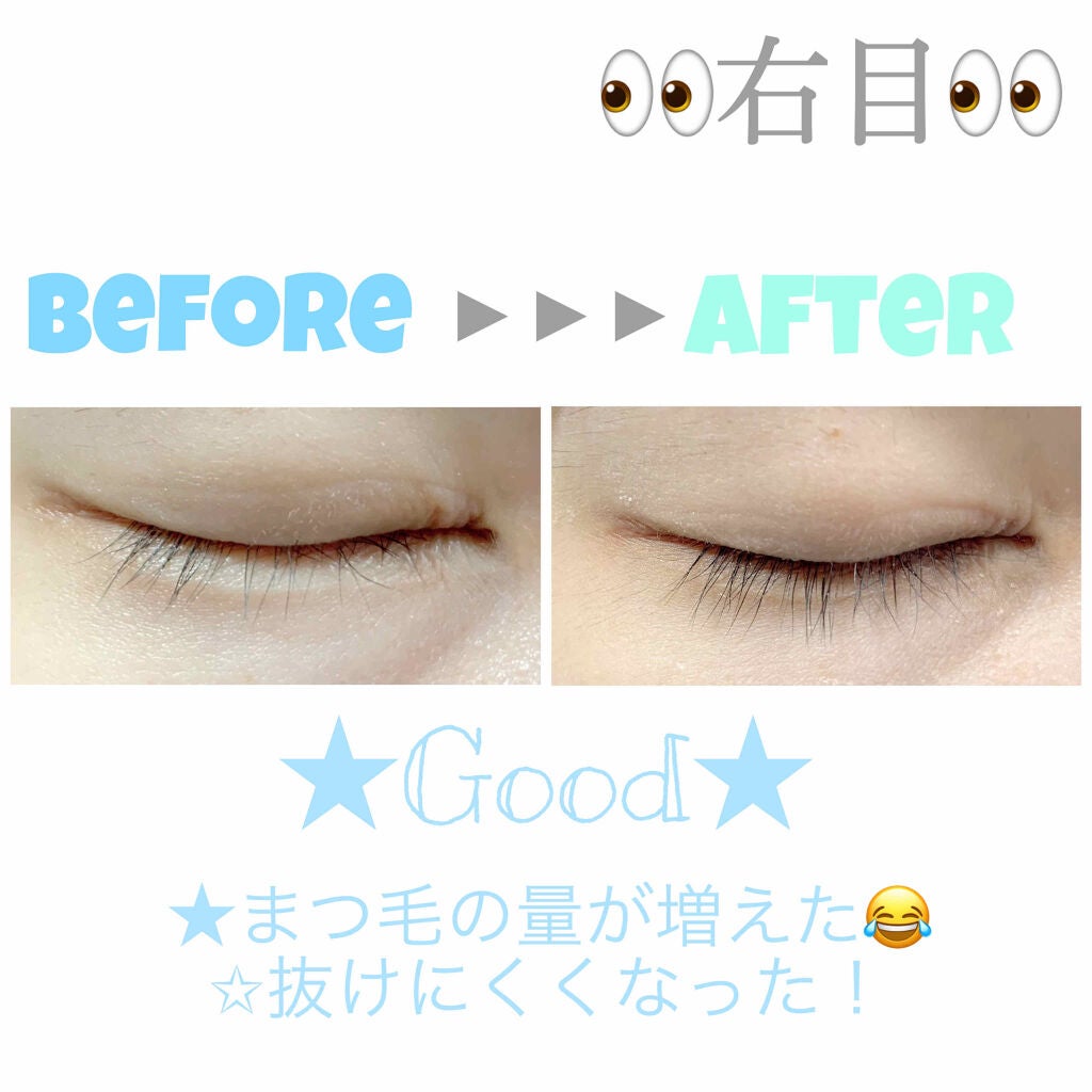 スカルプD ボーテ ピュアフリーアイラッシュセラム プレミアム/アンファー(スカルプD)/まつげ美容液を使ったクチコミ(3枚目)