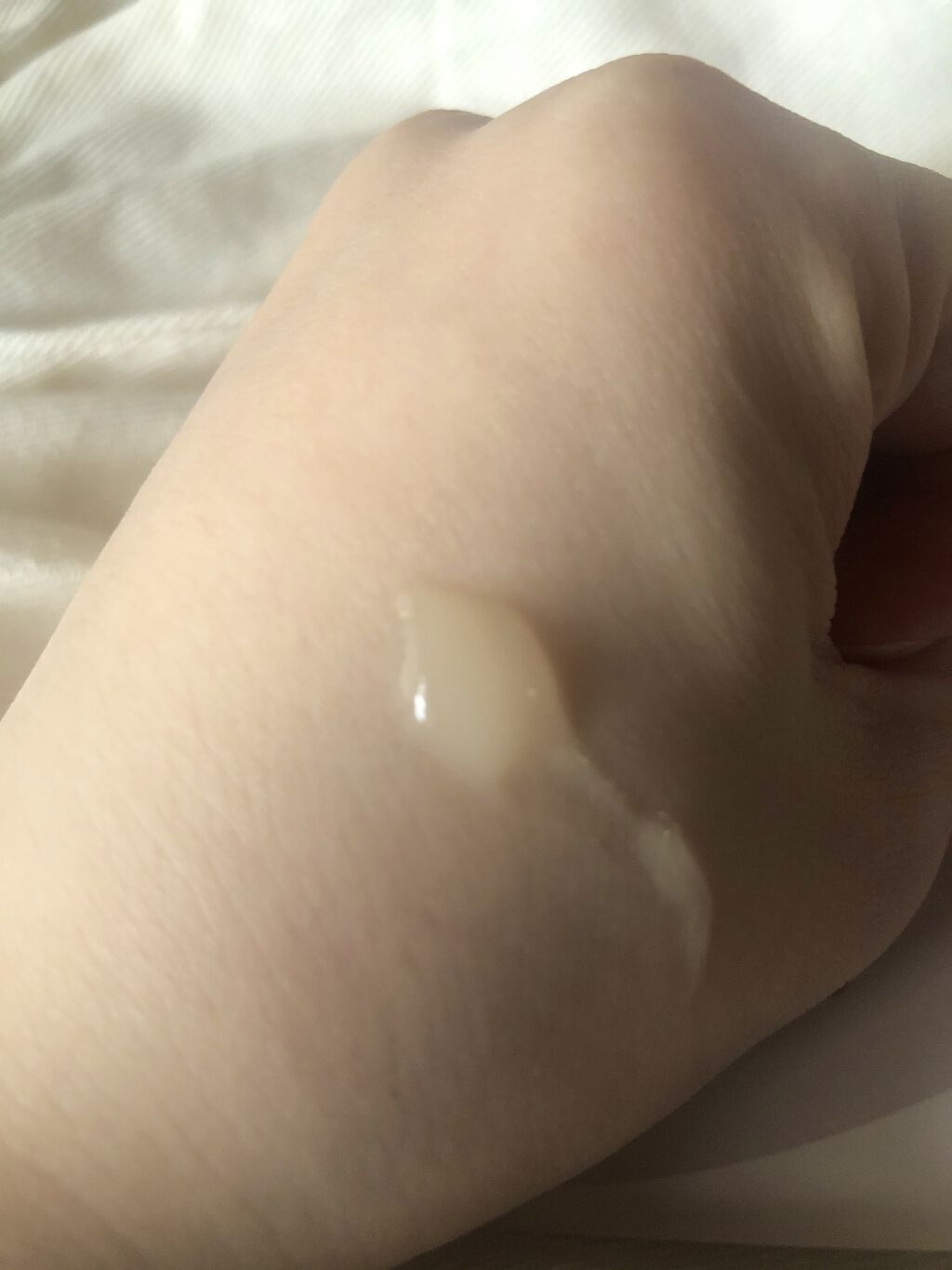 ニキビあとケアジェル/アットノン/その他スキンケアを使ったクチコミ（2枚目）