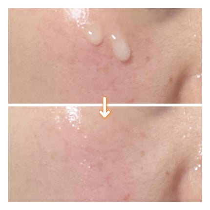 PDRNショット675/COSNORI/美容液を使ったクチコミ(5枚目)