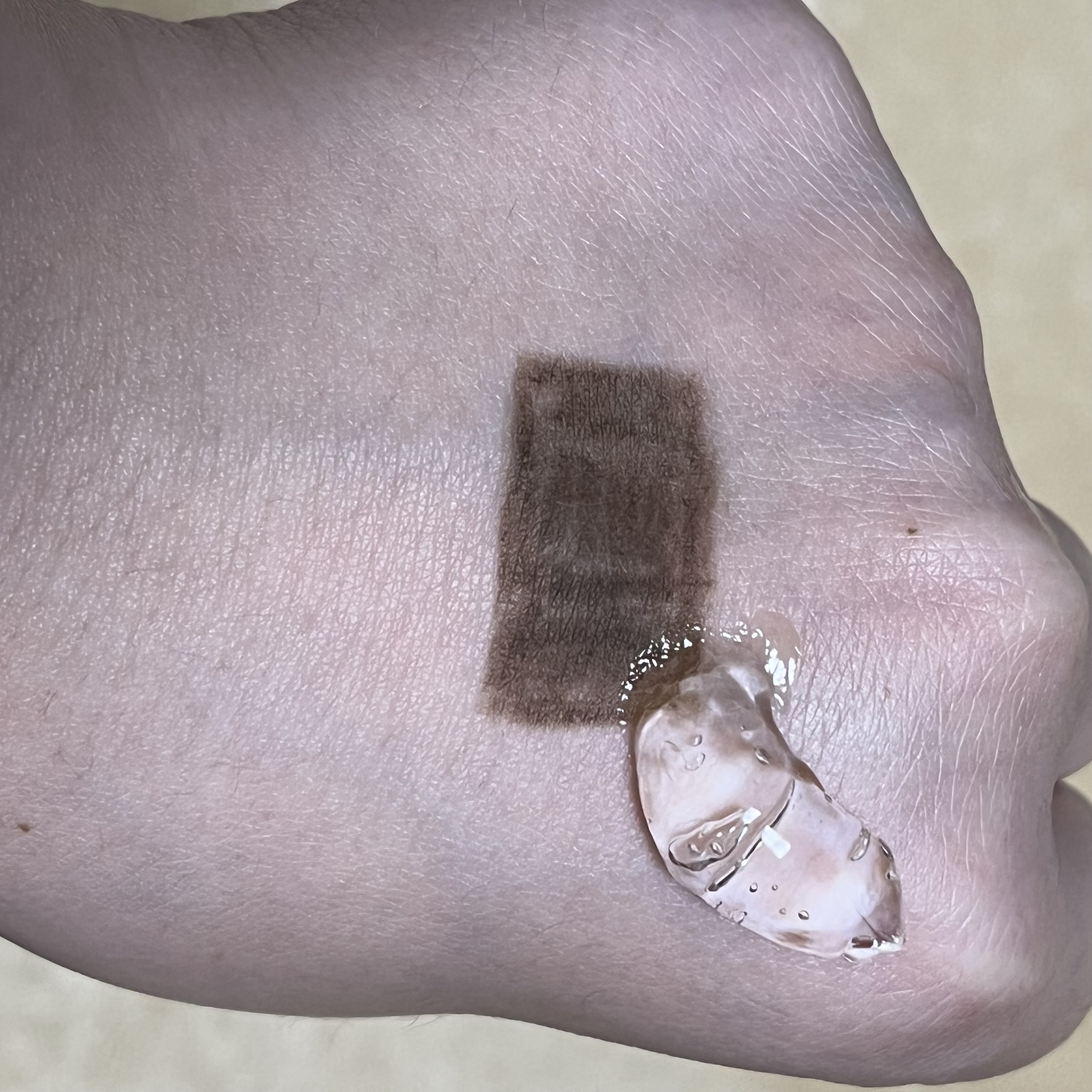 チョコブラ スペシャル毛穴ケアセット/Chocobra/スキンケアキットを使ったクチコミ（2枚目）