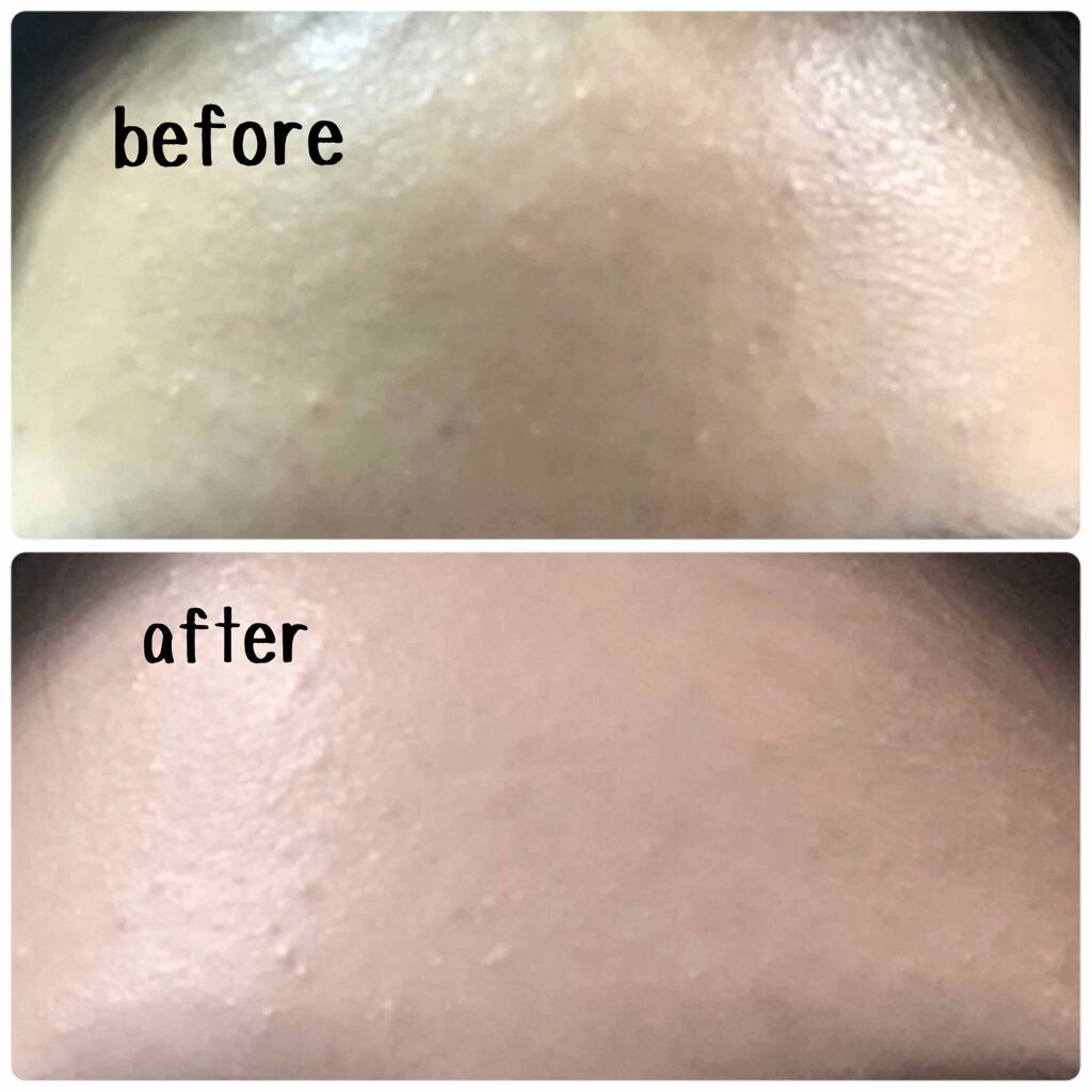 皮脂トラブルケア ミニセット 化粧水/キュレル/スキンケアキットを使ったクチコミ（2枚目）