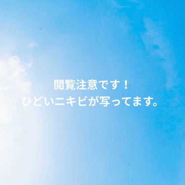 NOV ベースコントロールスムース ＵＶのクチコミ「こんにちは。
脂性肌の19歳女子です。

私は小学校からニキビが出来ていました。
しかしそれは.....」（1枚目）