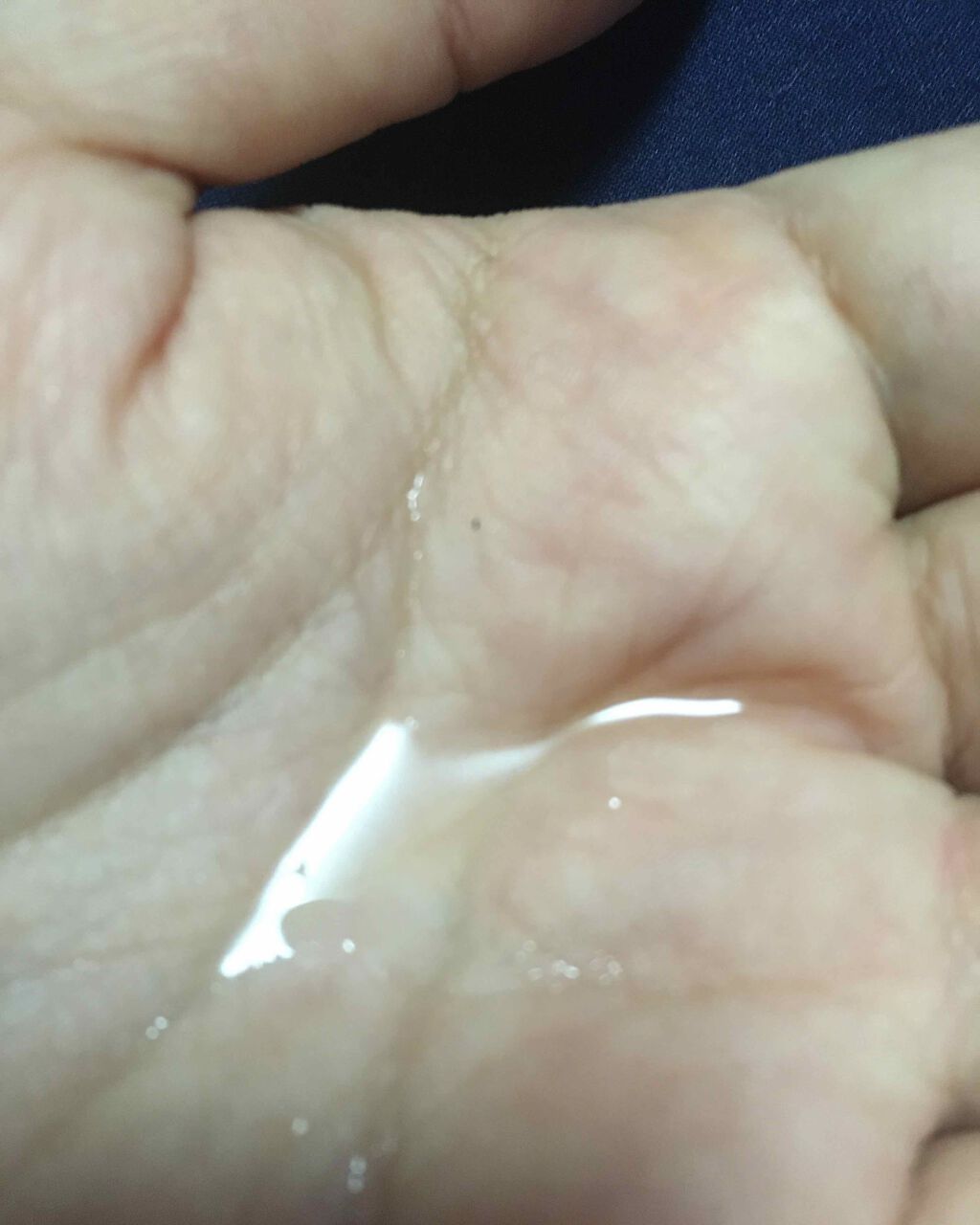 タカミスキンピール/タカミ/ブースター・導入液を使ったクチコミ(4枚目)