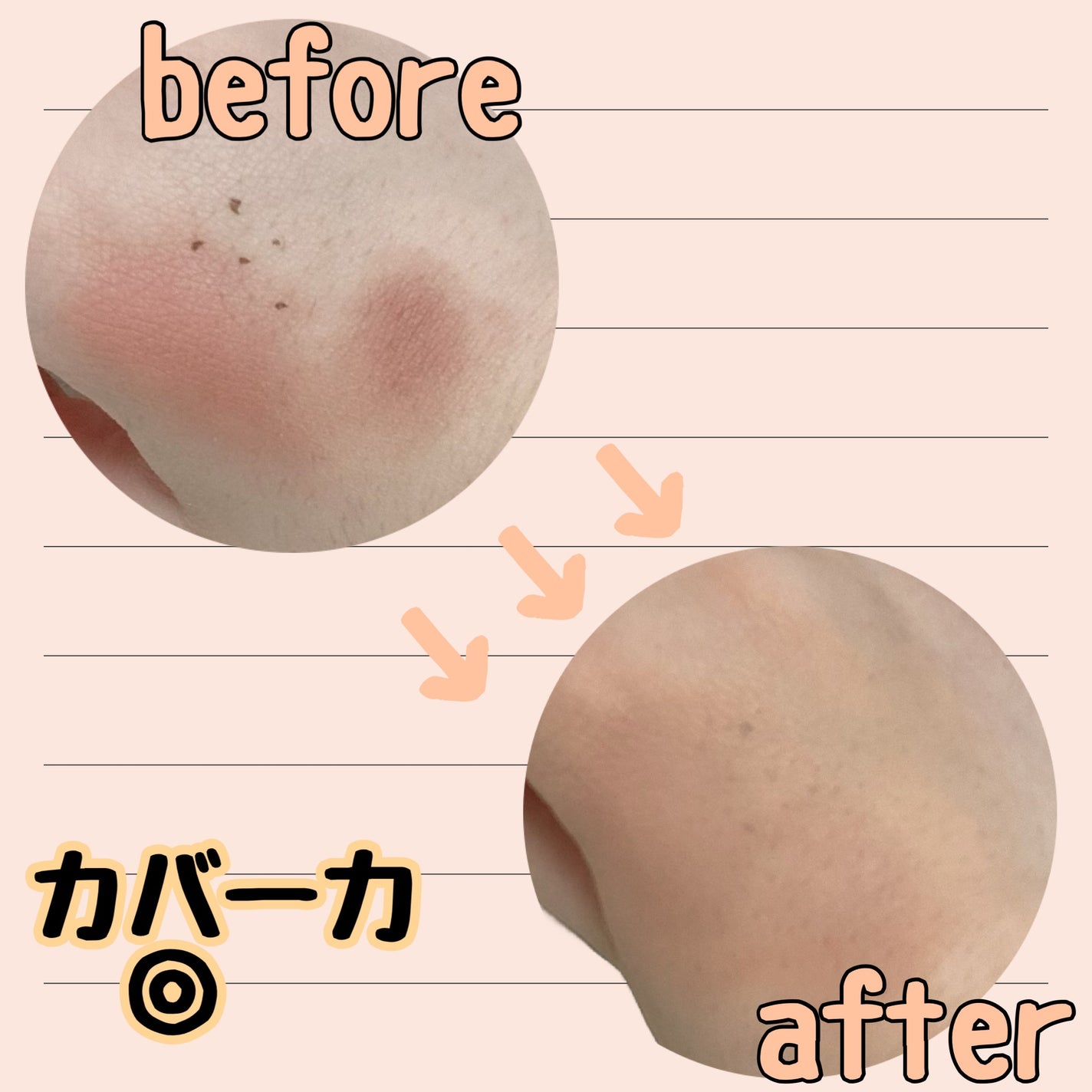 マジックコンシーラー/カリプソ/リキッドコンシーラーを使ったクチコミ(3枚目)