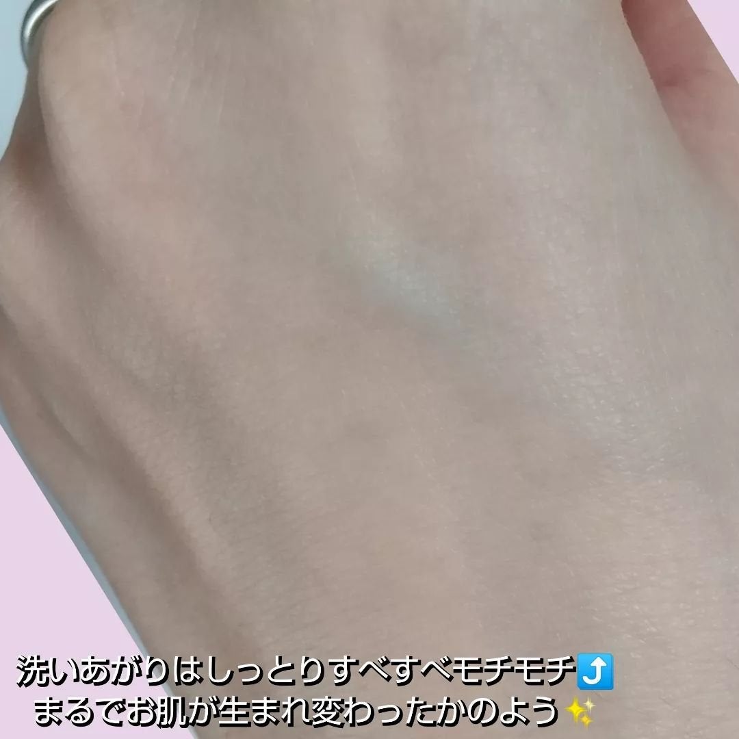 マイクロムース リフレッシャー/ALBLANC/泡洗顔を使ったクチコミ(8枚目)