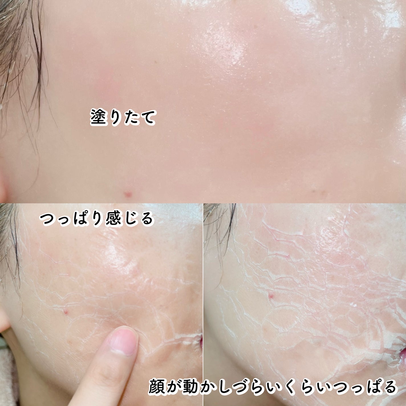 ゾンビビューティー ゾンビパック/SKIN1004/シートマスク・パックを使ったクチコミ(4枚目)