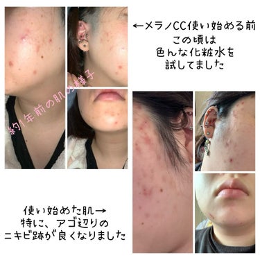 薬用しみ対策 美白化粧水 しっとりタイプ/メラノCC/化粧水を使ったクチコミ（2枚目）