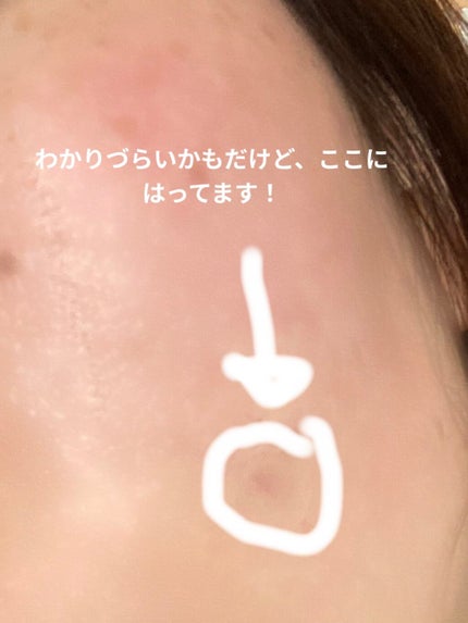 プロCICA クリアスポットパッチ/VT/その他スキンケアを使ったクチコミ(3枚目)