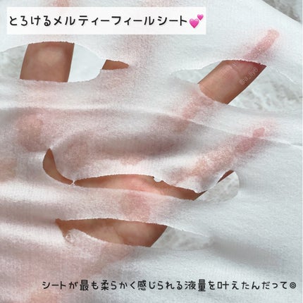 ルルルン ハイドラ EX マスク/ルルルン/シートマスク・パックを使ったクチコミ(5枚目)