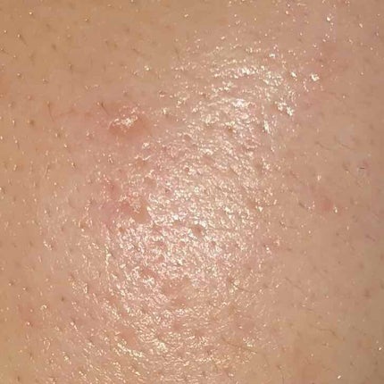 ジェルクリーム/ルナメアAC/フェイスクリームを使ったクチコミ(2枚目)