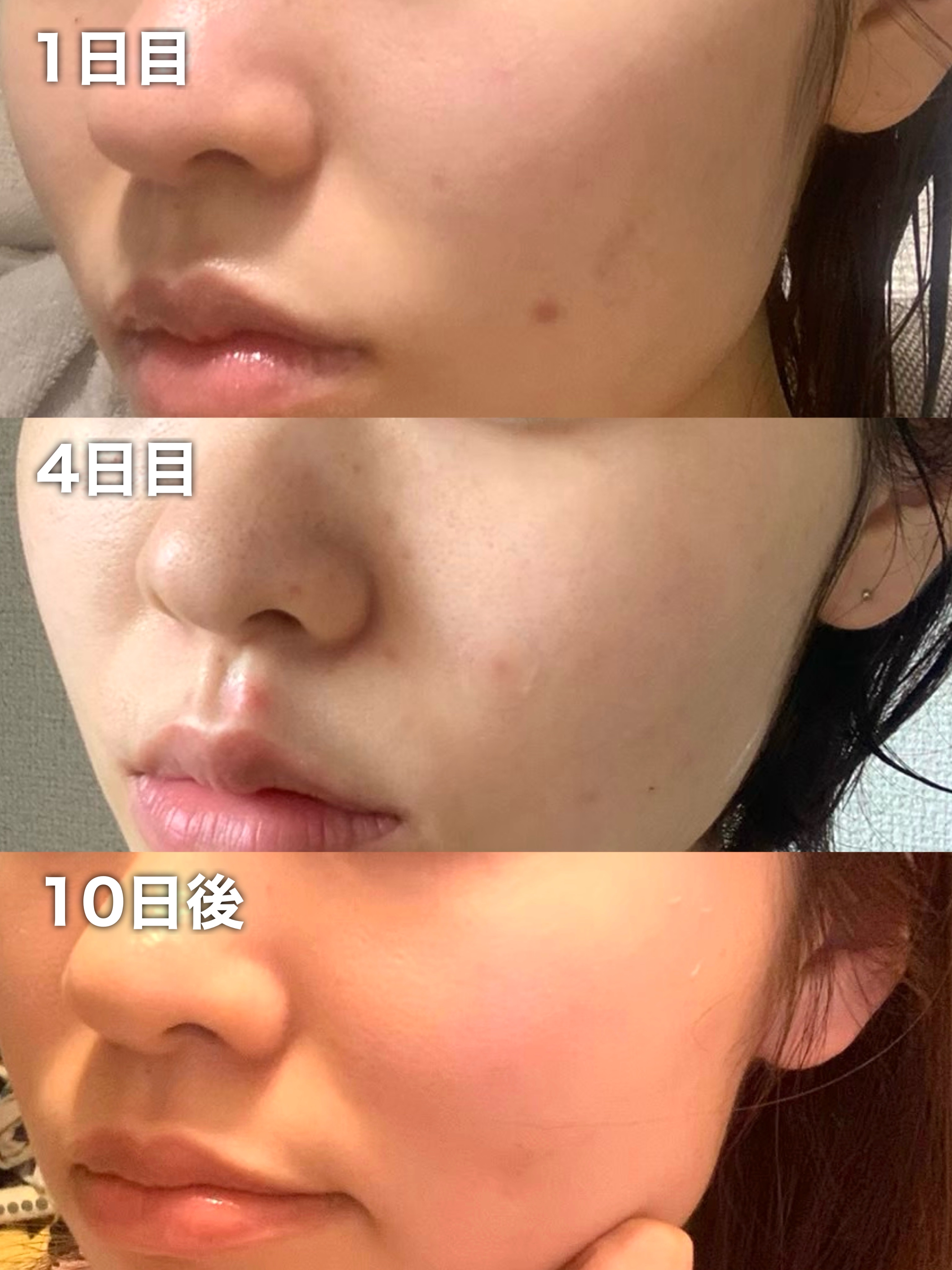 クリアパールワン ブライトエッセンス/HIKARI CLEAR オーガニック/美容液を使ったクチコミ（3枚目）