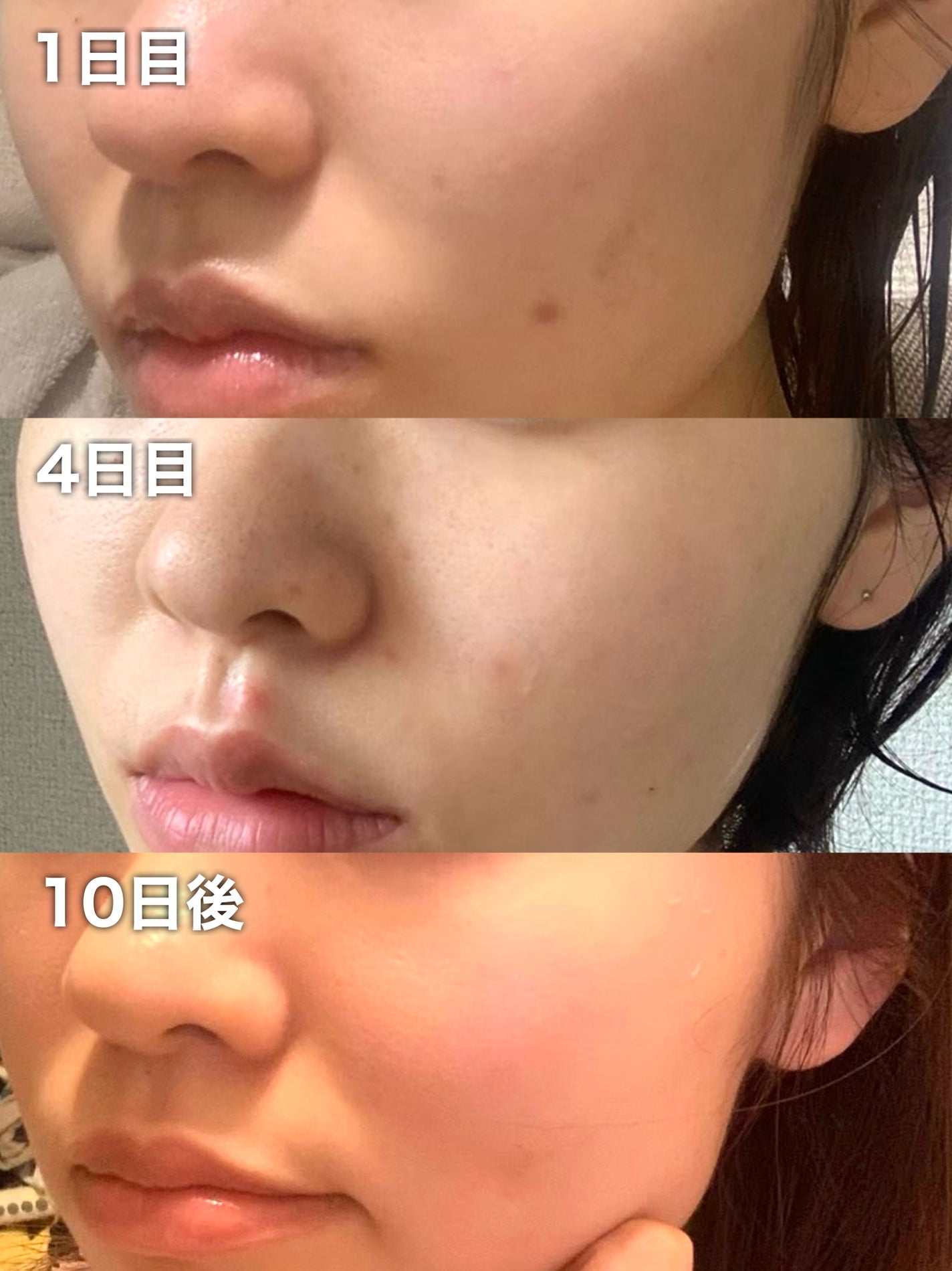 クリアパールワン ブライトエッセンス/HIKARI CLEAR オーガニック/美容液を使ったクチコミ(3枚目)