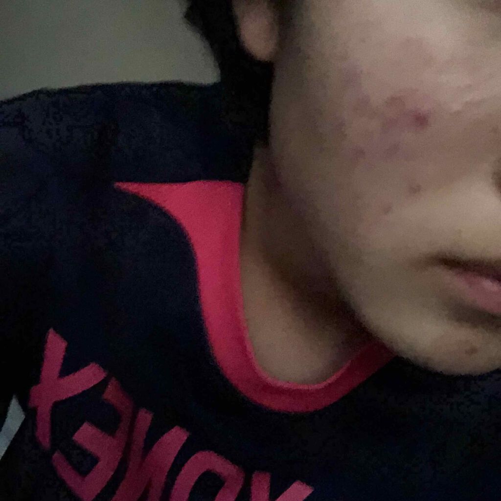 を使ったクチコミ（3枚目）