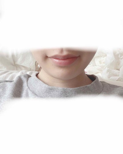 モアリップ N (医薬品)/資生堂薬品/その他を使ったクチコミ(3枚目)