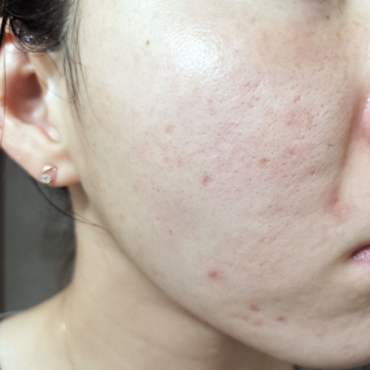 100プラントベースS/The Ordinary/美容液を使ったクチコミ（1枚目）