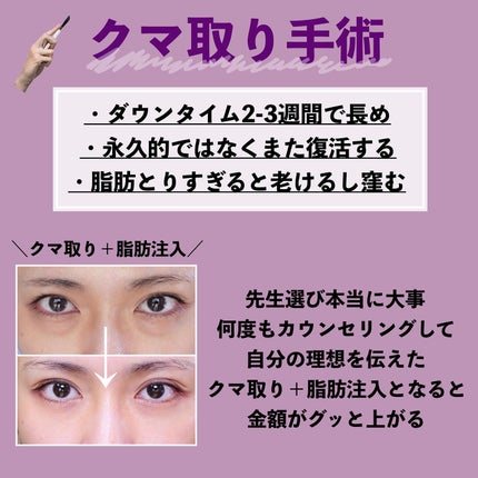 とみりー on LIPS 「美容医療デメリット詳細↓過去にやってきた美容医療のメリットは..」(4枚目)