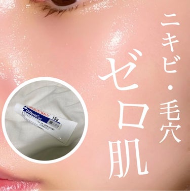 白湯(サユ) | ニキビと戦うOL🤍 on LIPS 「【これ1つでニキビ・毛穴ゼロ😳！？】万能すぎるディフェリンゲル..」（1枚目）