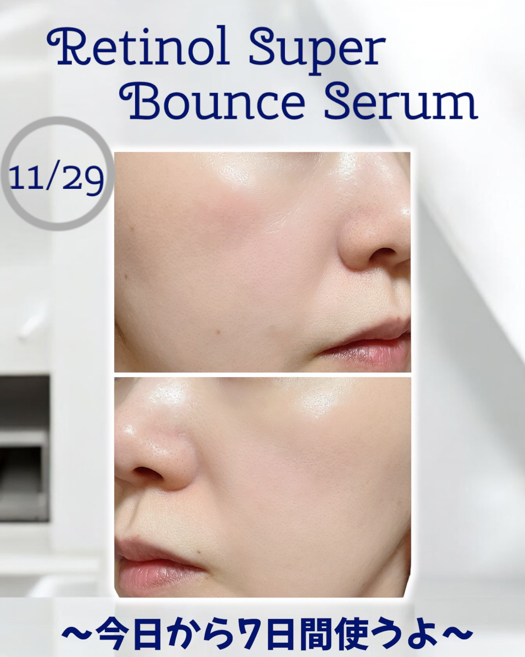 レチノール スーパーバウンス セラム/IOPE/美容液を使ったクチコミ（3枚目）