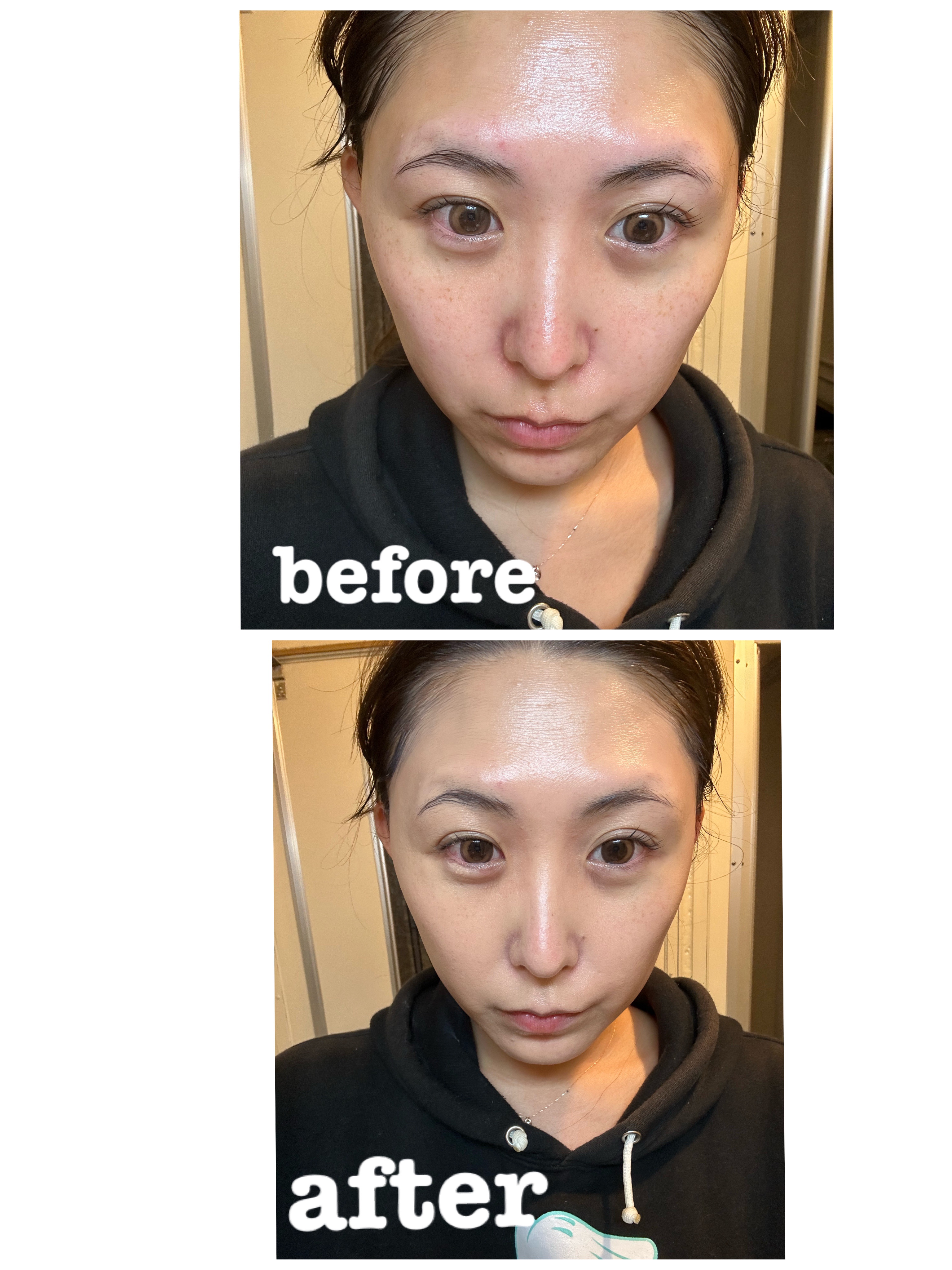 デューイーメッシュファンデーション/ASUNE /クッションファンデーションを使ったクチコミ（2枚目）