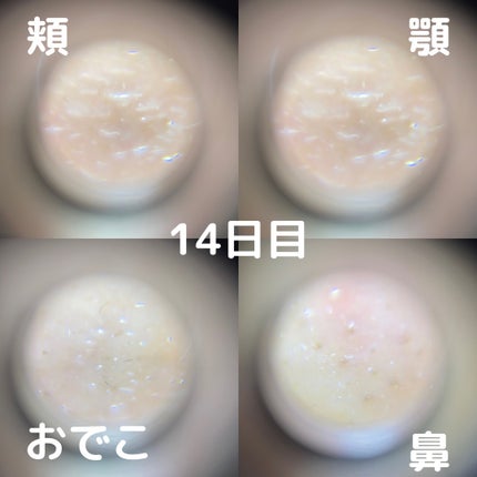 CICA クリーム/VT/フェイスクリームを使ったクチコミ(5枚目)