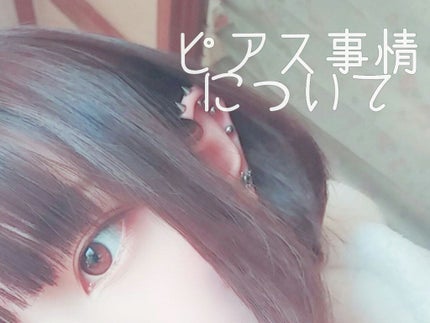 オキシドール(医薬品)/日本薬局方/その他を使ったクチコミ(1枚目)