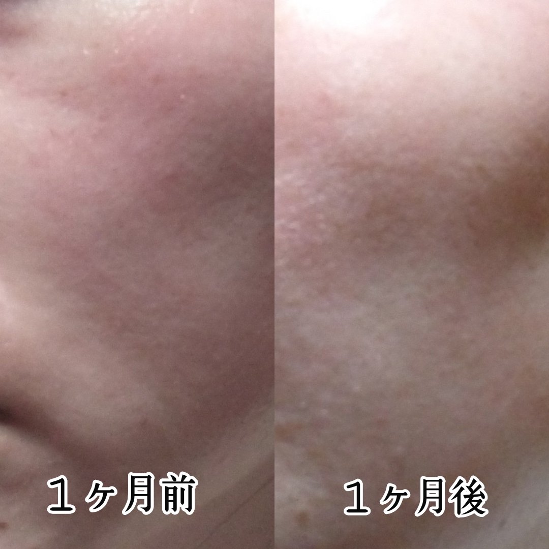 ディープ ビタC デイリー クイック マスク/MEDICUBE/シートマスク・パックを使ったクチコミ（2枚目）