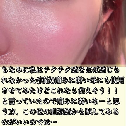 ビディ ニードルエッセンス GG/ビディ/美容液を使ったクチコミ(3枚目)