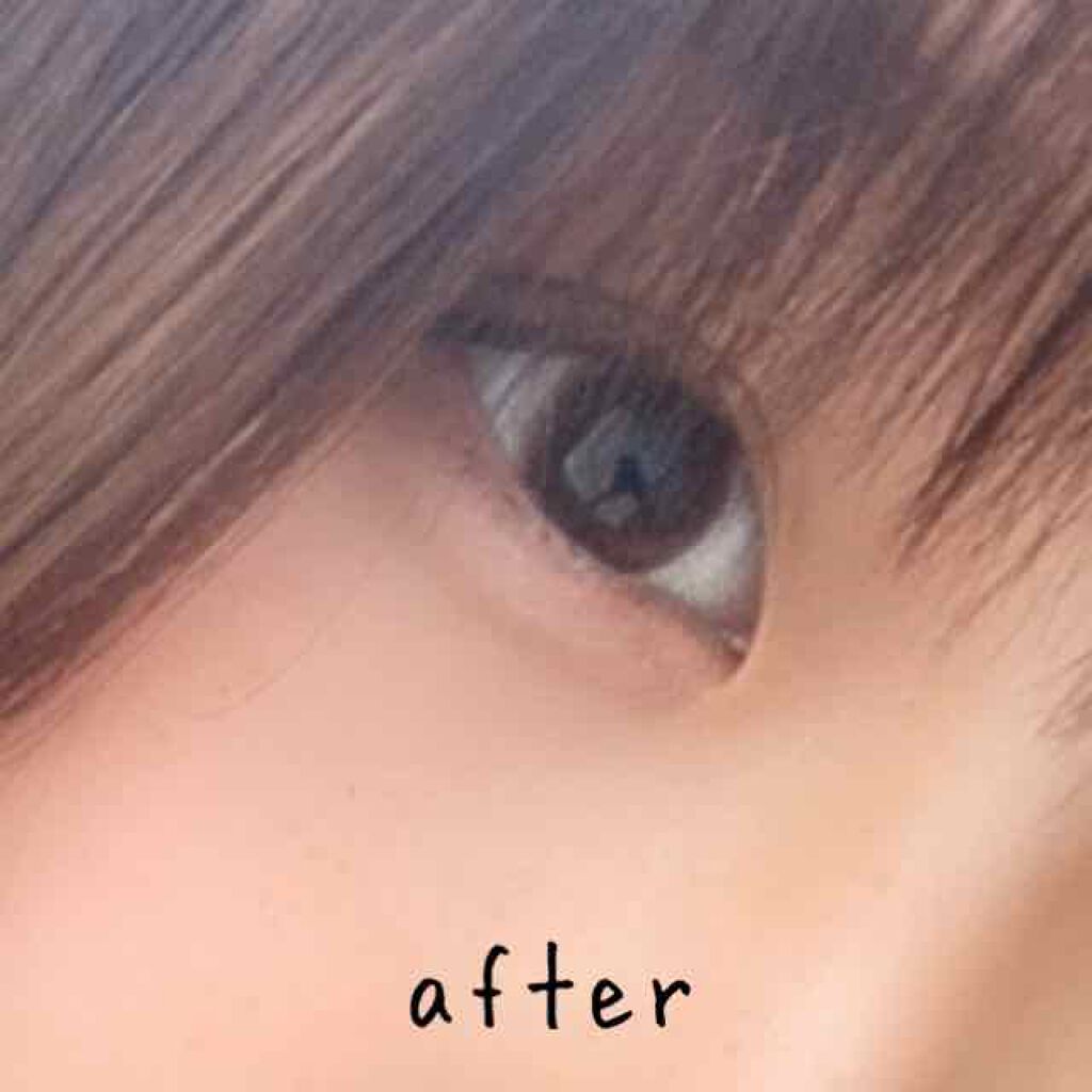 肌色タイプ/バンドエイド/その他を使ったクチコミ（3枚目）