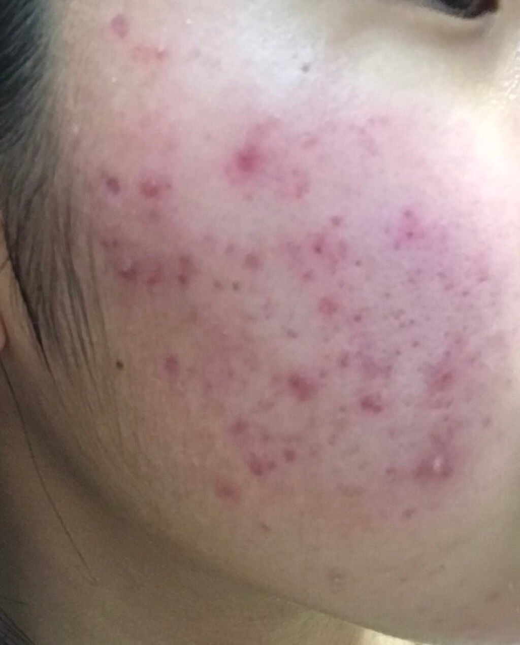 薬用美白 スキンケアパウダー ホワイトティーの香り/素肌記念日/プレストパウダーを使ったクチコミ(7枚目)