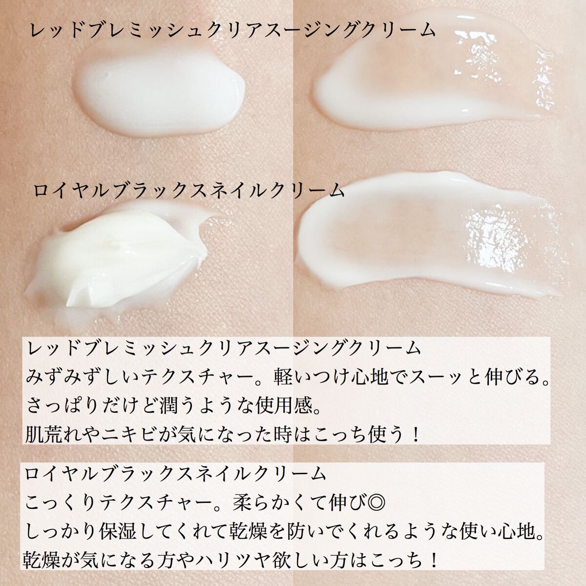 ロイヤルブラックスネイルクリーム/Dr.G/フェイスクリームを使ったクチコミ（3枚目）