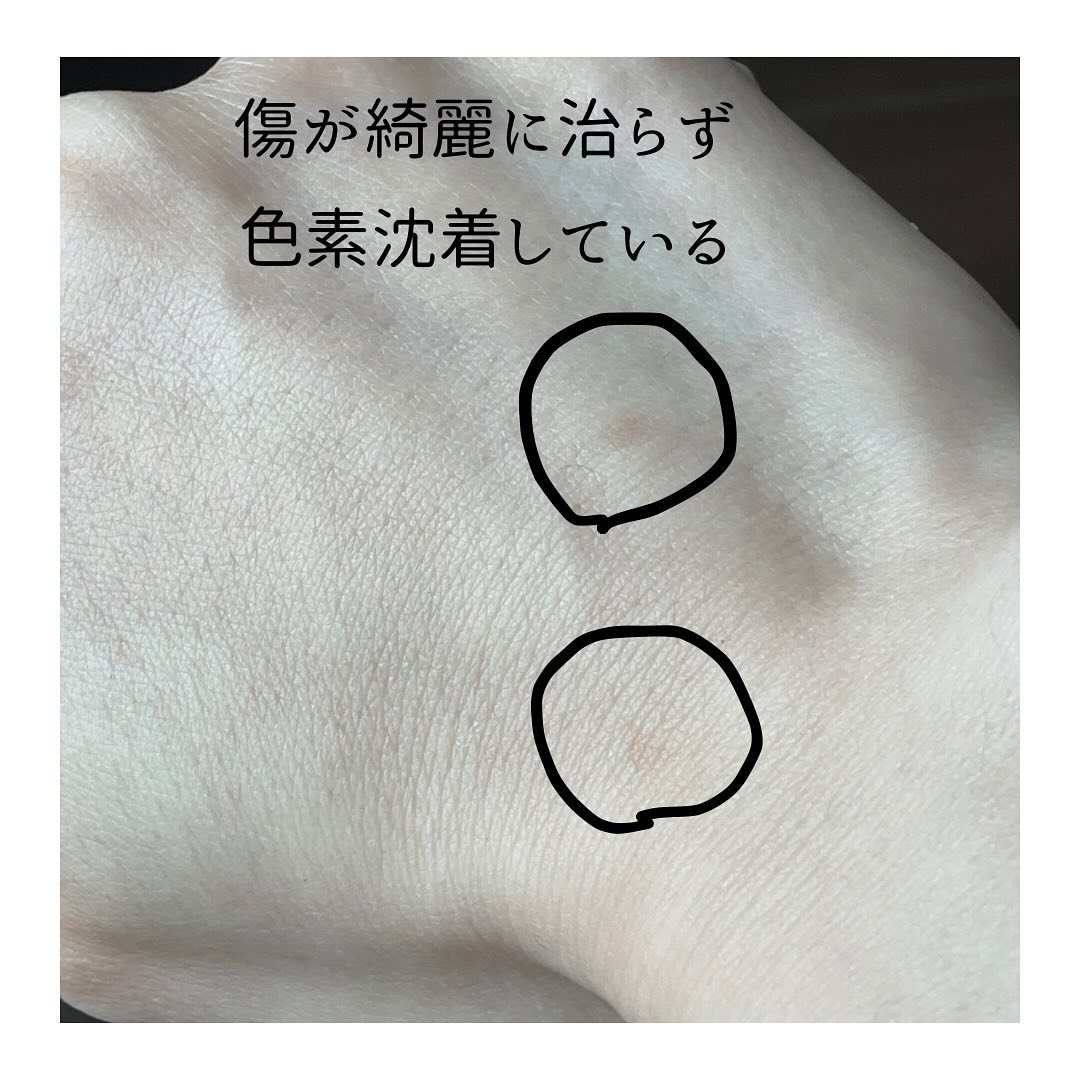 メラティノンクリーム/DERMA RESEARCH/フェイスクリームを使ったクチコミ（2枚目）