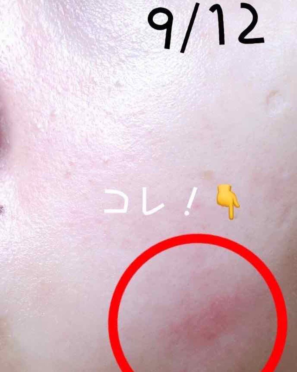 ワセリン/大洋製薬/ボディクリームを使ったクチコミ(2枚目)