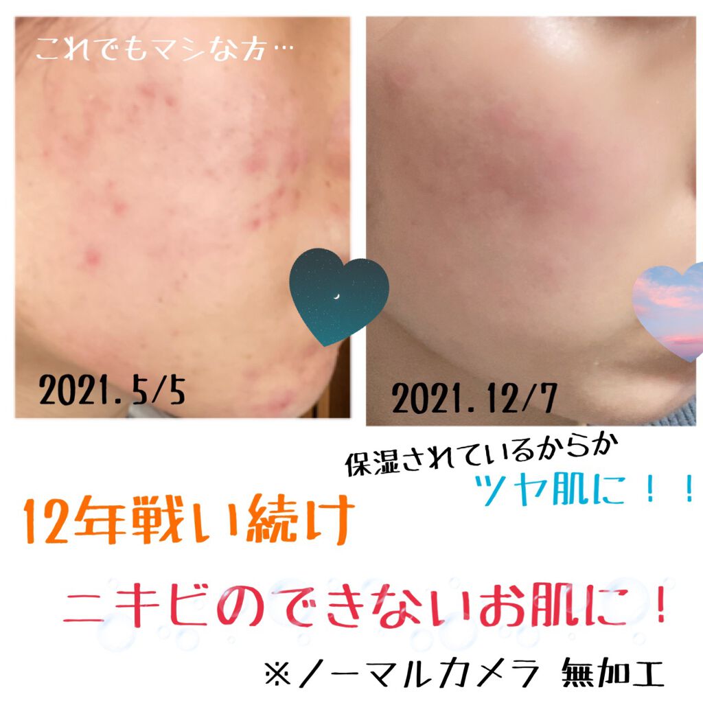 デュオ ザ クレンジングバーム/DUO/クレンジングバームを使ったクチコミ(2枚目)